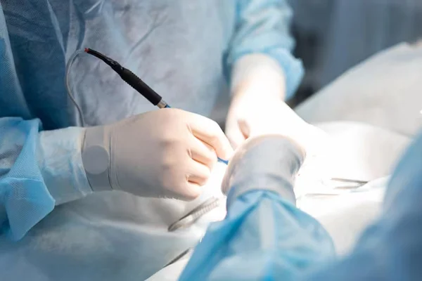 Other Abdominal Surgeries